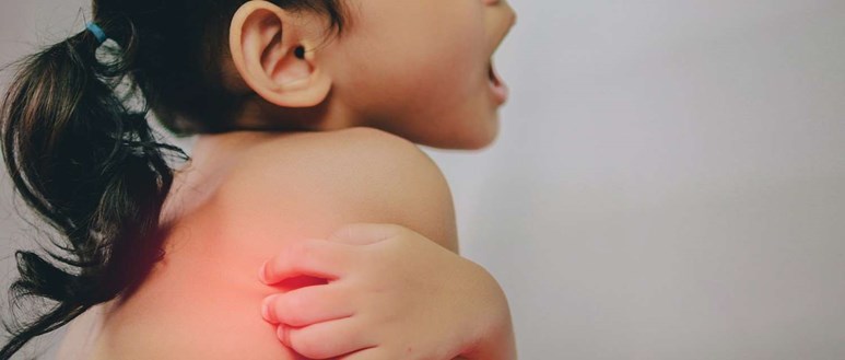 What to do when your child has a rash